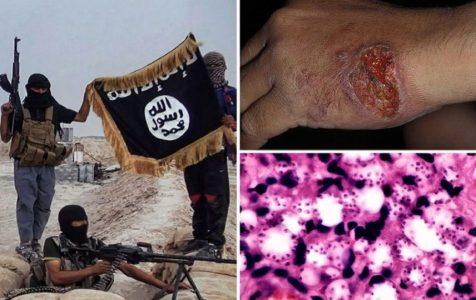 ISIS terrorist group is losing in Syria but it’s spreading deadly flesh-eating disease