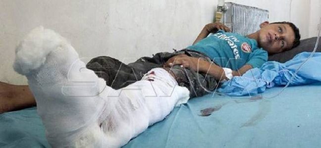 Two children injured in a mine blast left behind by Islamic State terrorists in Deir Ezzor