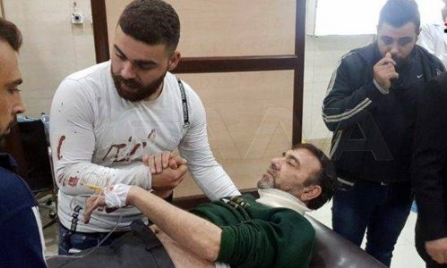 Three civilians wounded in a fresh terrorist shelling attack in Aleppo